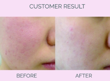 Customer Result Image