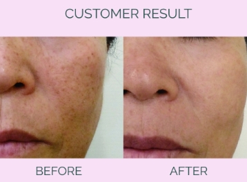 Customer Result Image