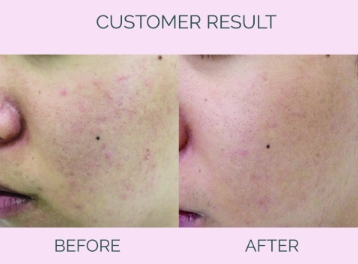 Customer Result Image