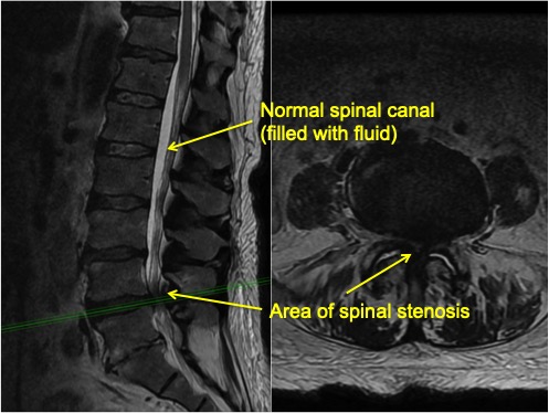 Surgical And Nonsurgical Spinal Decompression - Lubbock, Amarillo ...