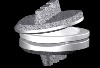Cervical artificial disc replacement