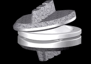 Cervical artificial disc replacement