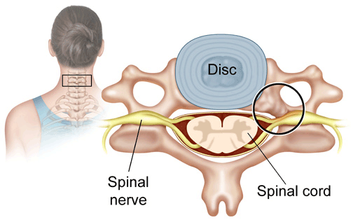 thecal sac cervical spine